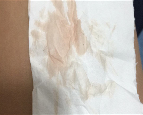 高龄产妇备孕二胎需要注意些什么问题呢