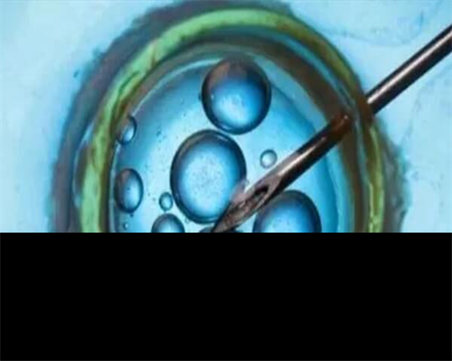 昆明试管婴儿费用明细表?