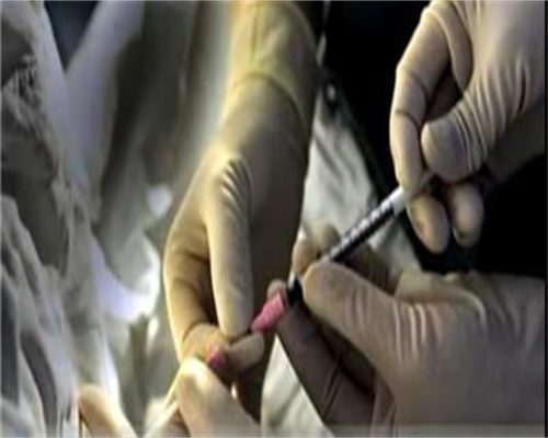 做试管为什么要查尿常规？移植前查尿常规和血常规