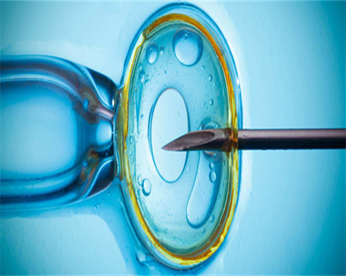 试管婴儿用查输卵管么