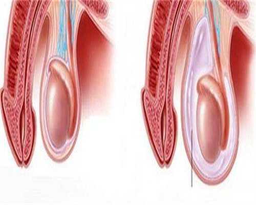 做三代试管婴儿受罪吗