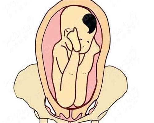 子宫肌瘤怎么检查