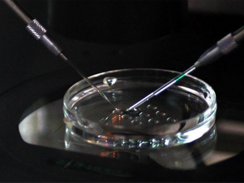 昆明试管婴儿可以选择试管吗，高标准信得过！