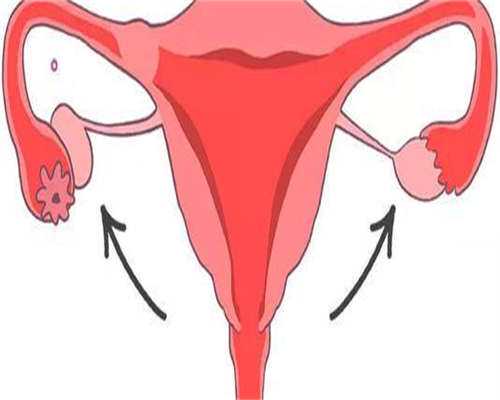 双子宫能怀孕吗