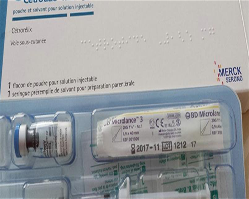 子宫肌瘤和子宫囊肿的区别