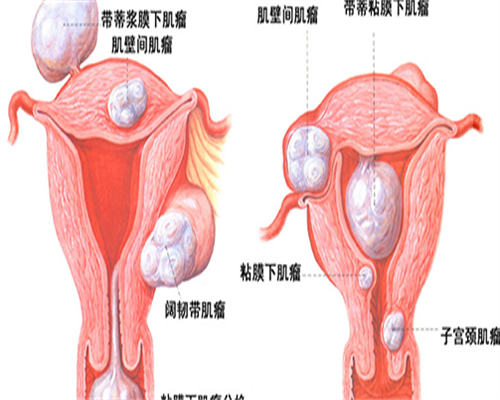 代妈应聘要求_国内代孕电话,
              多囊吃法地兰枸橼酸氯米芬片对提高怀