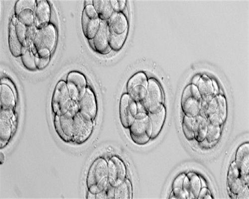 大龄女性生二胎要多少钱？