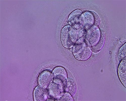 试管婴儿在哪里取卵