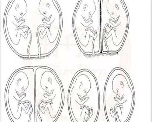 失独再生育申请补助的材料失独家庭再生育补助申请条件