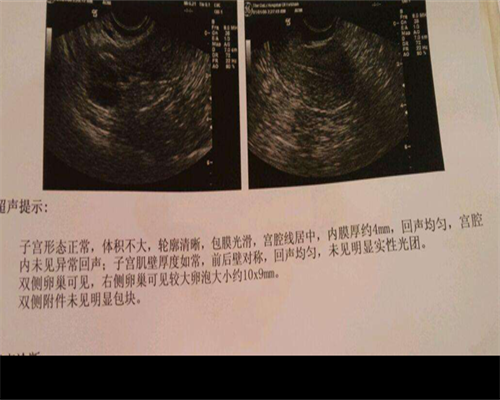 代生子包成功_代生机构包生女孩,40岁女性即将闭经，想要怀孕选对策略很关键