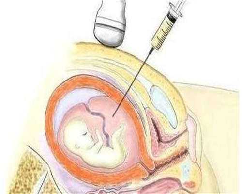 昆明做试管婴儿成功率多少，附时间、费用！
